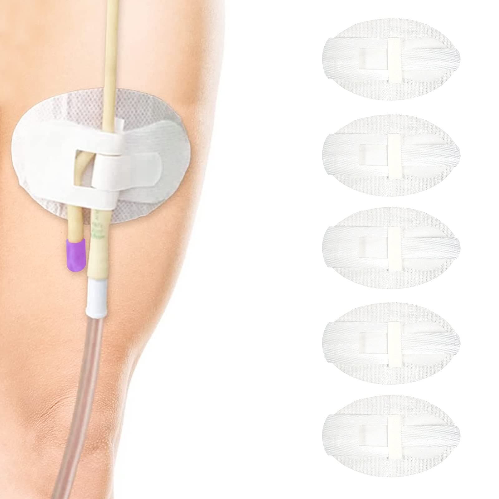 5Pcs Catheter HoldeCatheter Stabilization Device Legband Holder Sticker Urinary Tube Holder Universal Fixing Bands Catheter Tube Holder White (White-5Pcs)