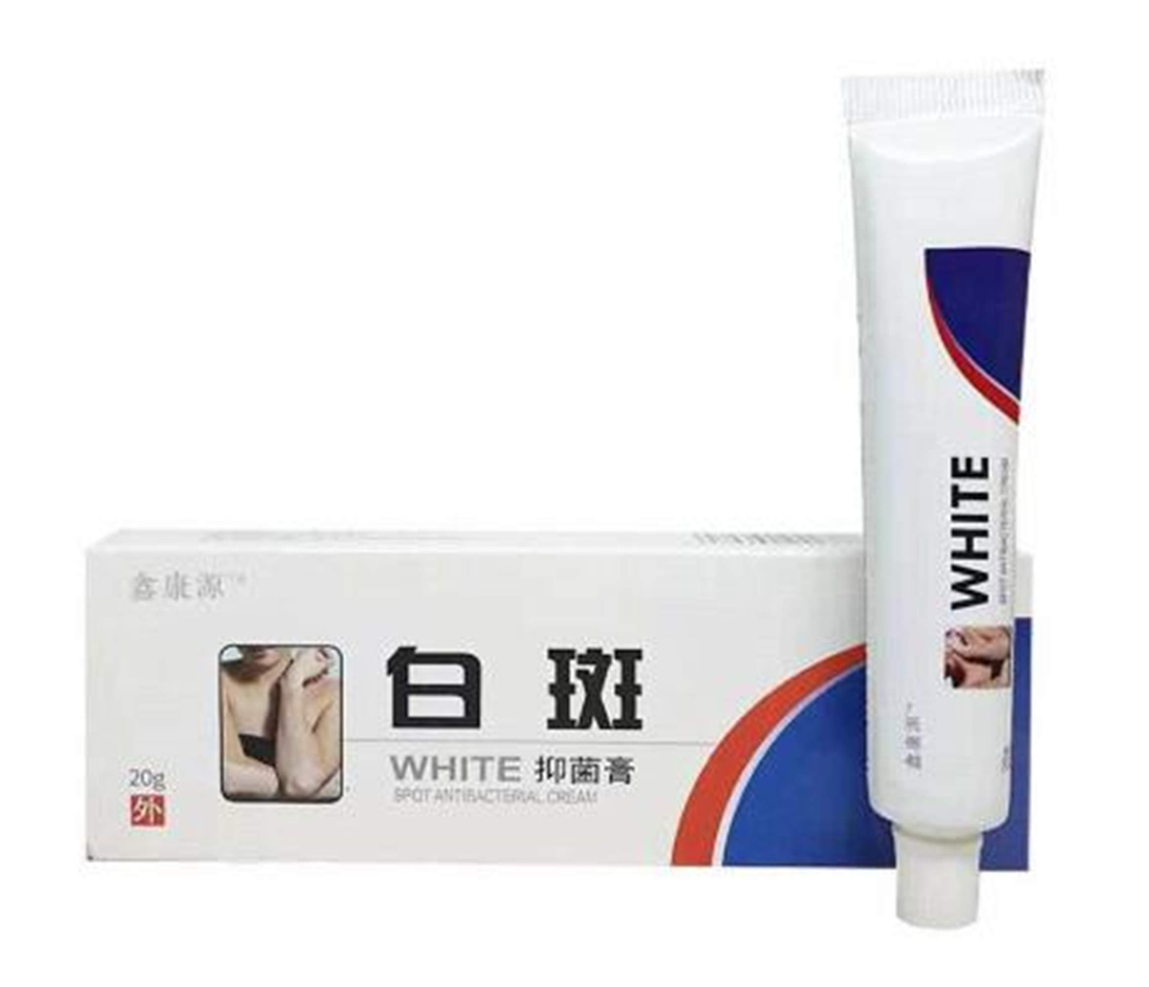 chinese herbal cream for Vitiligo White Spots Leukoplakia Re Pigmentation